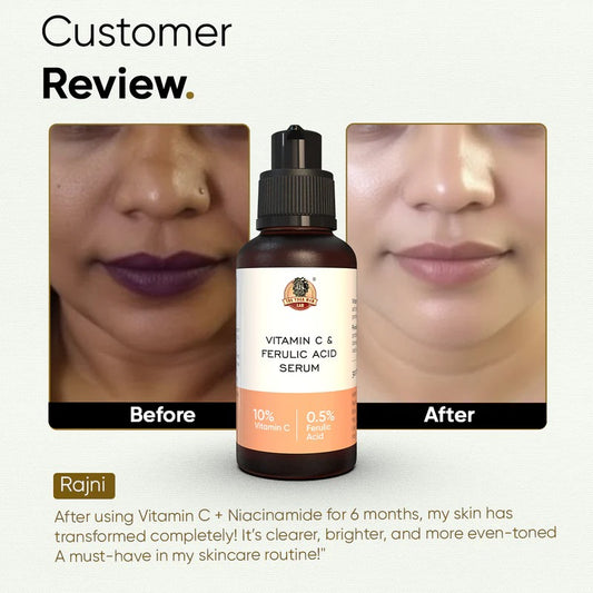 YogaManLab® 10% Pure Vitamin-C & 0.5% Ferulic Acid Face Serum | Brightens Dull Skin, Evens Tone