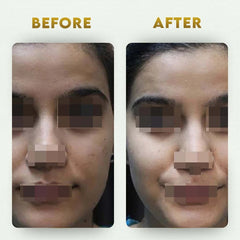 YogaManLab® Multani Mitti Glow Face Pack – For Deep Pore Cleansing, Acne Defense & Tan Removal (With Chandan, Turmeric & Orange Peel)