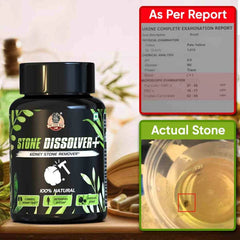 YogaManLab® STONE DISSOLVER+ - Stone Remover Ayurvedic Supplement | 100% Natural & Plant Based