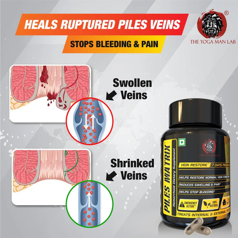 YogaManLab® PILES MATRIX - Vein Restore + Rectum Restore Ayurvedic Supplements + Herbal Remedies Diet Booklet | Relives Pain & Shrinks Mass | 100% Natural