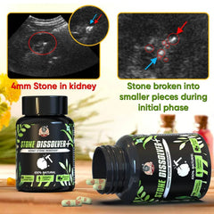 YogaManLab® STONE DISSOLVER+ - Stone Remover Ayurvedic Supplement | 100% Natural & Plant Based