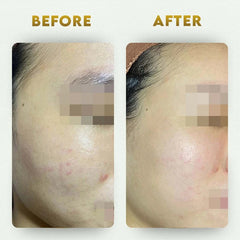 YogaManLab® Multani Mitti Glow Face Pack – For Deep Pore Cleansing, Acne Defense & Tan Removal (With Chandan, Turmeric & Orange Peel)