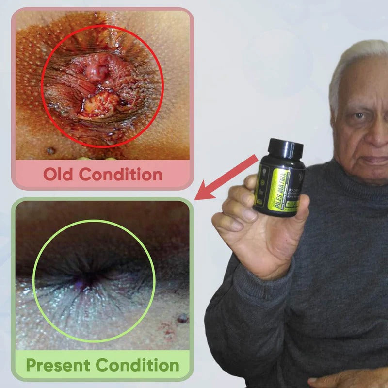 YogaManLab® PILES MATRIX - Ayurvedic Medicines for Piles Home Treatment | With Capsules, Lepam & Diet Booklet | Relives Pain & Itching, Shrinks Mass, & Treats Constipation | 100% Natural