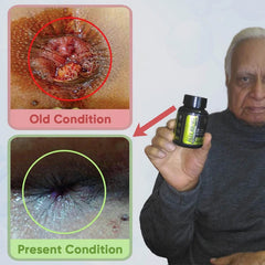 YogaManLab® PILES MATRIX - Ayurvedic Medicines for Piles Home Treatment | With Capsules, Lepam & Diet Booklet | Relives Pain & Itching, Shrinks Mass, & Treats Constipation | 100% Natural