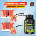YogaManLab® PILES MATRIX - Vein Restore + Rectum Restore Ayurvedic Supplements + Herbal Remedies Diet Booklet | Relives Pain & Shrinks Mass | 100% Natural