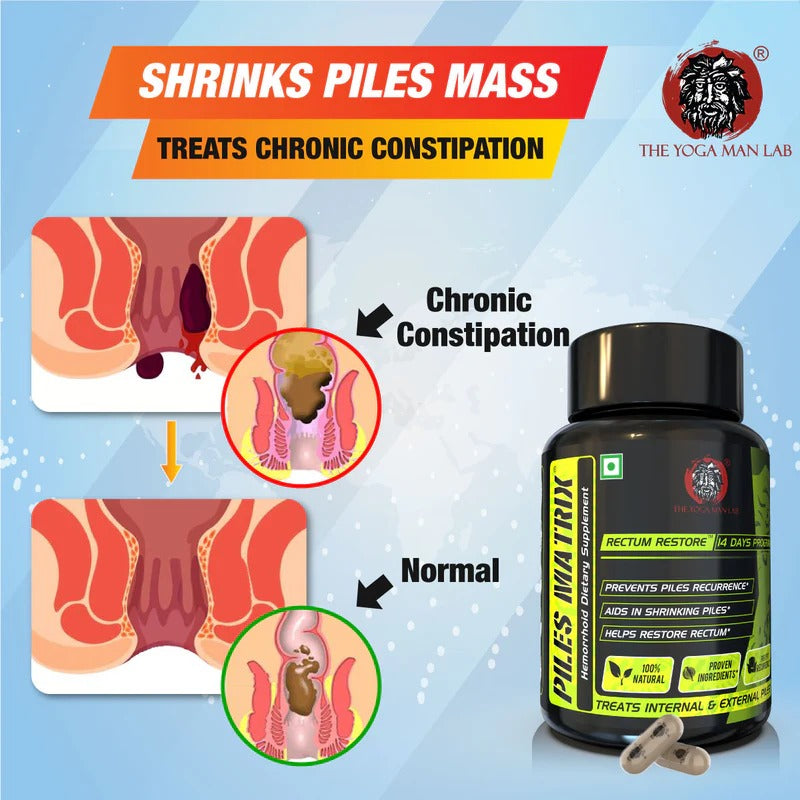 YogaManLab® PILES MATRIX - Vein Restore + Rectum Restore Ayurvedic Supplements + Herbal Remedies Diet Booklet | Relives Pain & Shrinks Mass | 100% Natural
