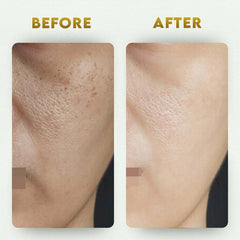 YogaManLab® Glutathione Skin Whitening Kojic Acid Soap | Makes Skin Bright & Glowing | Glutathione, Chandan, Haldi, Kesar, Sandal Wood and Saffron Soap | For Men & Women Skin