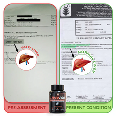 YogaManLab® Liver Pro - Fatty Liver Ayurvedic Supplement | Helps Restore Liver Health & Remove Toxins | 100% Natural & Ayurvedic | 28 Days Program