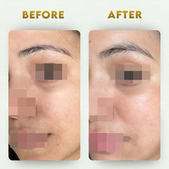 YogaManLab® Multani Mitti Glow Face Pack – For Deep Pore Cleansing, Acne Defense & Tan Removal (With Chandan, Turmeric & Orange Peel)