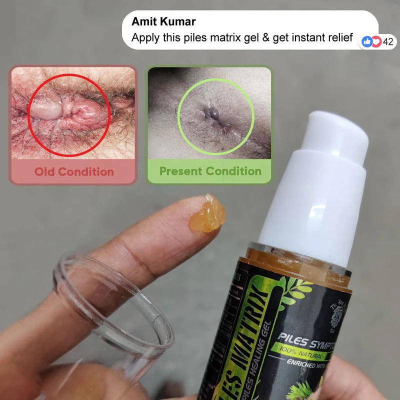 YogaManLab® PILES MATRIX - Ayurvedic Medicines for Piles Home Treatment | With Capsules, Lepam & Diet Booklet | Relives Pain & Itching, Shrinks Mass, & Treats Constipation | 100% Natural