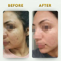 YogaManLab® Glutathione Skin Whitening Kojic Acid Soap | Makes Skin Bright & Glowing | Glutathione, Chandan, Haldi, Kesar, Sandal Wood and Saffron Soap | For Men & Women Skin