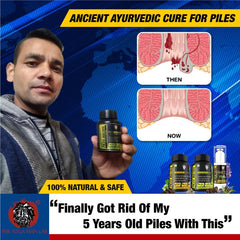 YogaManLab® PILES MATRIX - Vein Restore + Rectum Restore Ayurvedic Supplements + Herbal Remedies Diet Booklet | Relives Pain & Shrinks Mass | 100% Natural