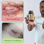 YogaManLab® PILES MATRIX - Ayurvedic Medicines for Piles Home Treatment | With Capsules, Lepam & Diet Booklet | Relives Pain & Itching, Shrinks Mass, & Treats Constipation | 100% Natural