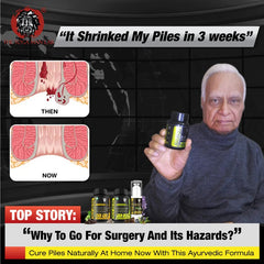 YogaManLab® PILES MATRIX - Vein Restore + Rectum Restore Ayurvedic Supplements + Herbal Remedies Diet Booklet | Relives Pain & Shrinks Mass | 100% Natural