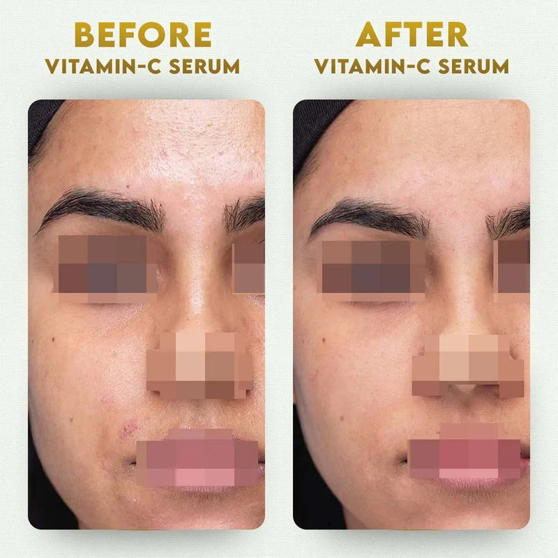 YogaManLab® 10% Pure Vitamin-C & 0.5% Ferulic Acid Face Serum | Brightens Dull Skin, Evens Tone