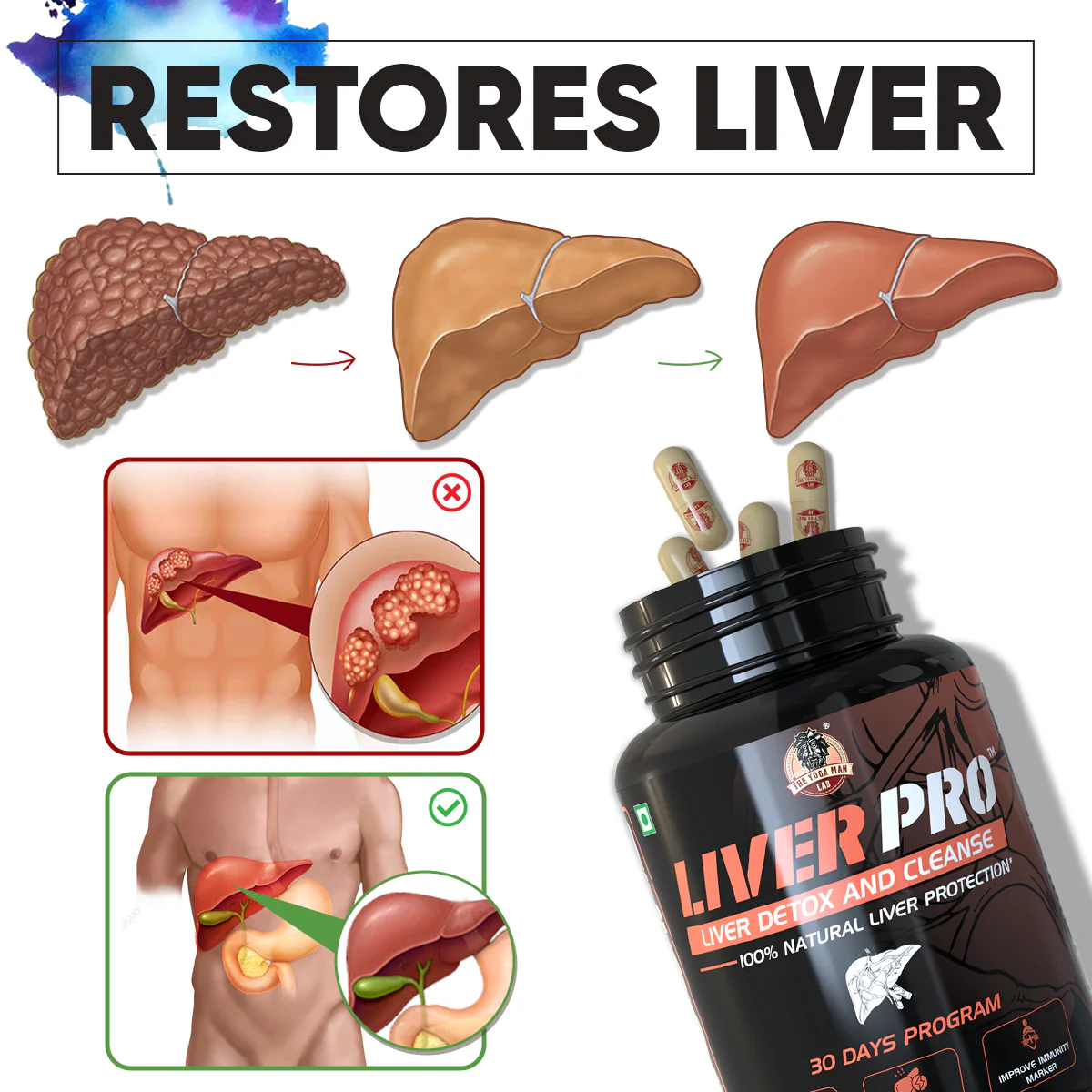 YogaManLab® Liver Pro - Fatty Liver Ayurvedic Supplement | Helps Restore Liver Health & Remove Toxins | 100% Natural & Ayurvedic | 28 Days Program Main image