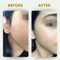 YogaManLab® Multani Mitti Glow Face Pack – For Deep Pore Cleansing, Acne Defense & Tan Removal (With Chandan, Turmeric & Orange Peel)