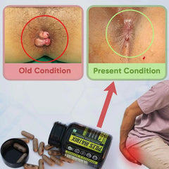 YogaManLab® PILES MATRIX - Ayurvedic Medicines for Piles Home Treatment | With Capsules, Lepam & Diet Booklet | Relives Pain & Itching, Shrinks Mass, & Treats Constipation | 100% Natural