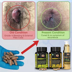 YogaManLab® PILES MATRIX - Ayurvedic Medicines for Piles Home Treatment | With Capsules, Lepam & Diet Booklet | Relives Pain & Itching, Shrinks Mass, & Treats Constipation | 100% Natural