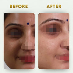 YogaManLab® Multani Mitti Glow Face Pack – For Deep Pore Cleansing, Acne Defense & Tan Removal (With Chandan, Turmeric & Orange Peel)