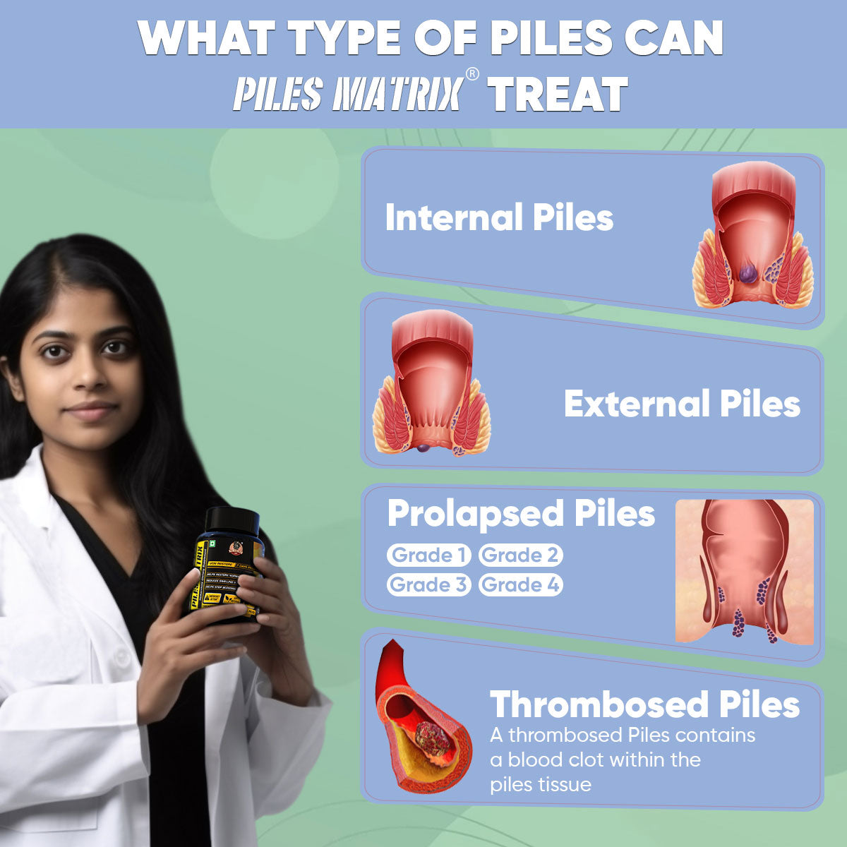 PILES MATRIX - Piles Treatment Ayurvedic Capsules & Lepam Ointment | With Free Diet & Doctor | Treats Internal Grade1-4 & External Hemorrhoids | 100% Natural